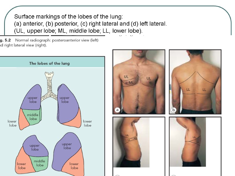 Surface markings of the lobes of the lung: (a) anterior, (b) posterior, (c) right